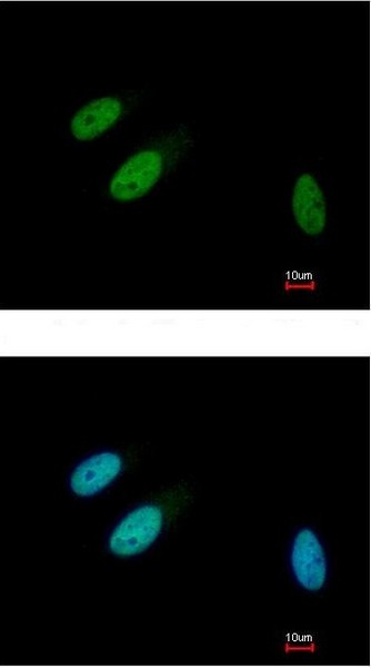 Immunocytochemistry/ Immunofluorescence - Anti-TRIB3 antibody (AB137526), expandable thumbnail