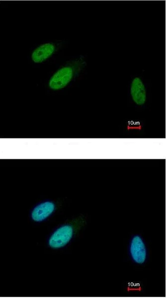 Immunocytochemistry/ Immunofluorescence - Anti-TRIB3 antibody (AB137526)