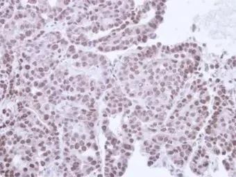 Immunohistochemistry (Formalin/PFA-fixed paraffin-embedded sections) - Anti-TRIB3 antibody (AB137526)