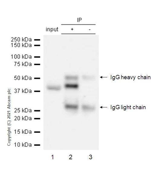 Immunoprecipitation - Anti-TRIB3 antibody [EPR3151Y] (AB75846)