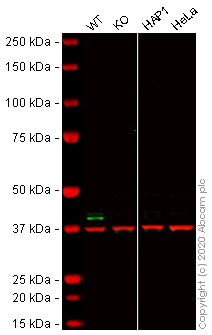 Western blot - Anti-TRIB3 antibody [EPR3151Y] (AB75846), expandable thumbnail