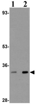 Western blot - Anti-TRIC-B antibody (AB106401), expandable thumbnail