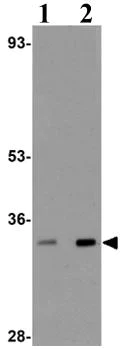 Western blot - Anti-TRIC-B antibody (AB106401)