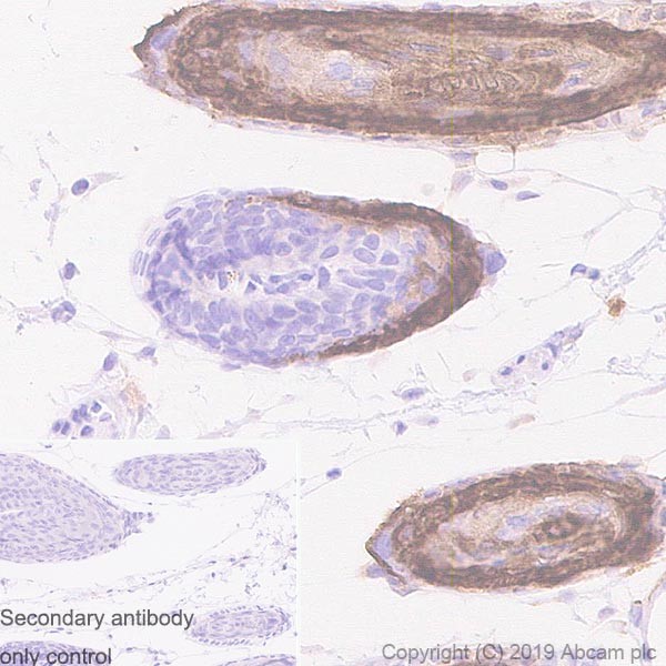 Immunohistochemistry (Formalin/PFA-fixed paraffin-embedded sections) - Anti-Trichohyalin antibody [AE15] - BSA and Azide free (AB255965), expandable thumbnail