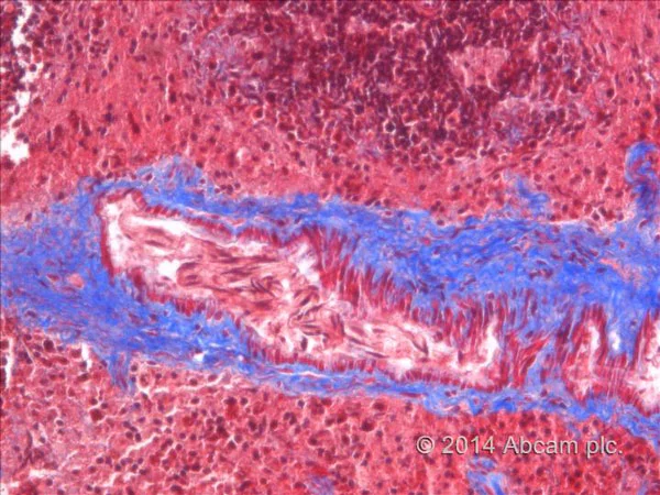 Immunohistochemistry (Formalin/PFA-fixed paraffin-embedded sections) - Trichrome Stain Kit (Connective Tissue Stain) (AB150686)