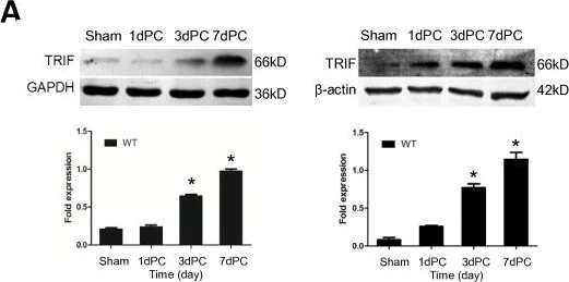 Western blot - Anti-TRIF antibody (AB13810)