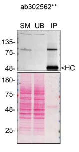 Immunoprecipitation - Anti-TRIF (TICAM1) antibody [EPR24995-152] (BSA and Azide free) (AB302563)