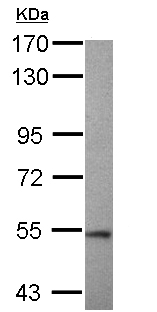 Western blot - Anti-TRIM11 antibody (AB111694)