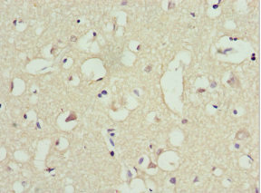 Immunohistochemistry (Formalin/PFA-fixed paraffin-embedded sections) - Anti-TRIM13 antibody (AB234847), expandable thumbnail