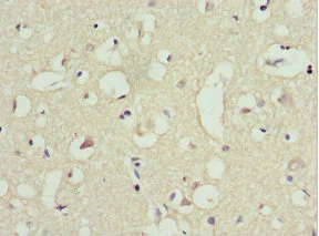 Immunohistochemistry (Formalin/PFA-fixed paraffin-embedded sections) - Anti-TRIM13 antibody (AB234847)