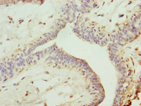Immunohistochemistry (Formalin/PFA-fixed paraffin-embedded sections) - Anti-TRIM13 antibody (AB234847), expandable thumbnail