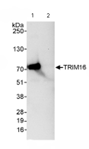 Immunoprecipitation - Anti-TRIM16 antibody (AB72129), expandable thumbnail
