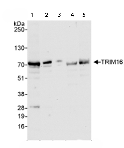 Western blot - Anti-TRIM16 antibody (AB72129), expandable thumbnail