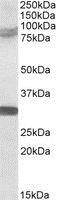 Western blot - Anti-TRIM2 antibody (AB3942)