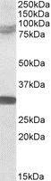 Western blot - Anti-TRIM2 antibody (AB3942)