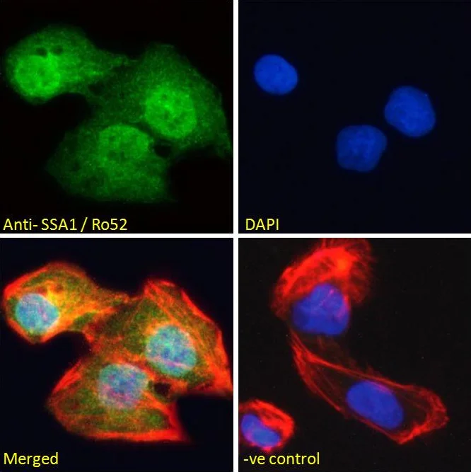 Immunocytochemistry/ Immunofluorescence - Anti-TRIM21/SS-A antibody (AB4369)