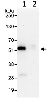 Immunoprecipitation - Anti-TRIM21/SS-A antibody (AB91423)