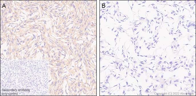 Immunohistochemistry (Formalin/PFA-fixed paraffin-embedded sections) - Anti-TRIM21/SS-A antibody [EPR20290] (ab207728), expandable thumbnail