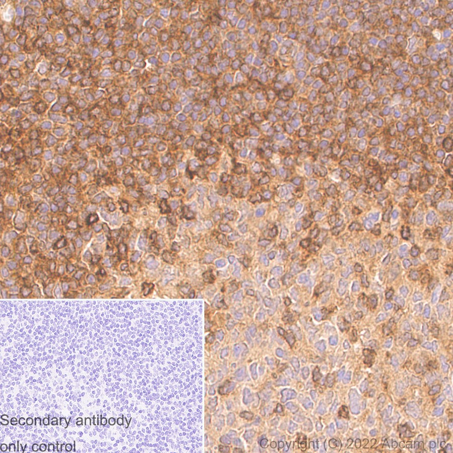 Immunohistochemistry (Formalin/PFA-fixed paraffin-embedded sections) - Anti-TRIM21/SS-A antibody [EPR20290] - BSA and Azide free (AB232549)