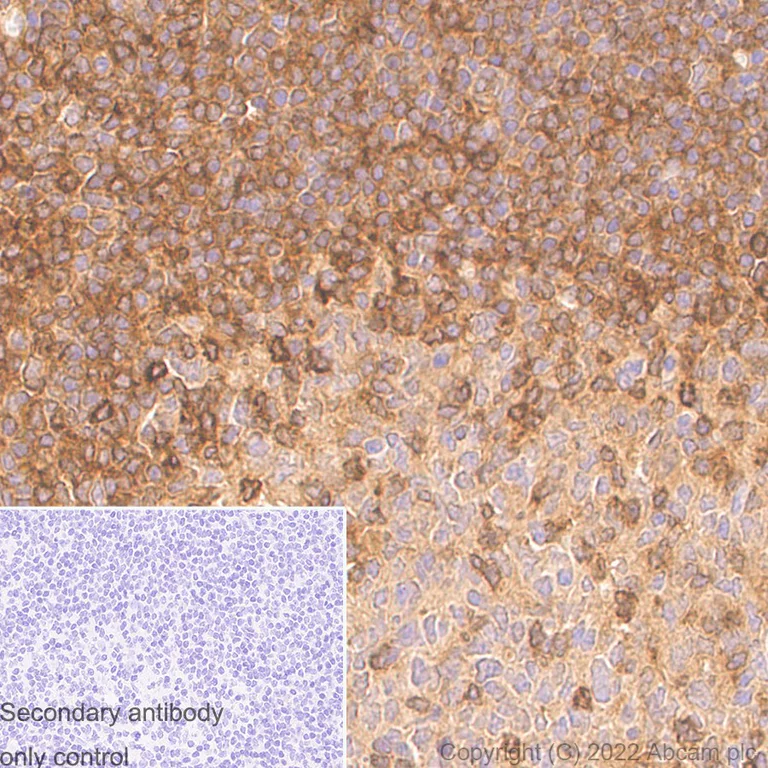 Immunohistochemistry (Formalin/PFA-fixed paraffin-embedded sections) - Anti-TRIM21/SS-A antibody [EPR20290] - BSA and Azide free (AB232549)