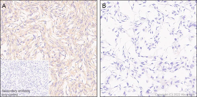 Immunohistochemistry (Formalin/PFA-fixed paraffin-embedded sections) - Anti-TRIM21/SS-A antibody [EPR20290] - BSA and Azide free (AB232549)