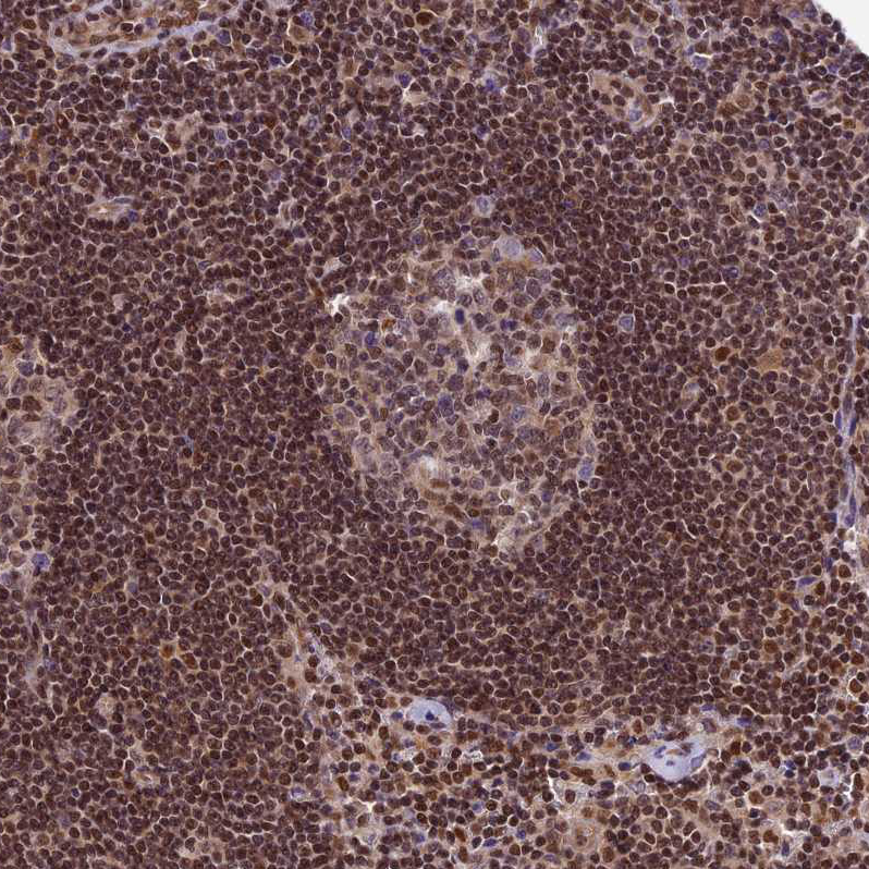 Immunohistochemistry (Formalin/PFA-fixed paraffin-embedded sections) - Anti-TRIM22 antibody (AB224059), expandable thumbnail