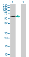 Western blot - Anti-TRIM22 antibody (AB68071), expandable thumbnail