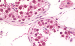 Immunohistochemistry (Formalin/PFA-fixed paraffin-embedded sections) - Anti-TRIM24 antibody (AB211300), expandable thumbnail