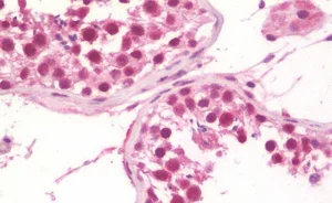Immunohistochemistry (Formalin/PFA-fixed paraffin-embedded sections) - Anti-TRIM24 antibody (AB211300)