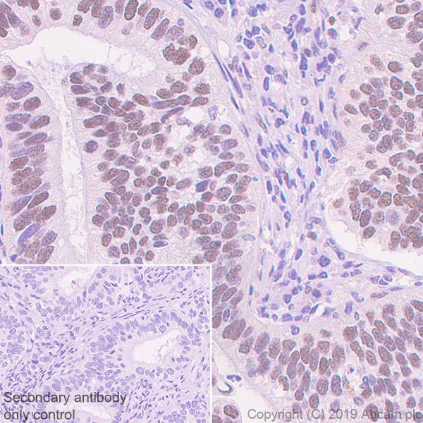 Immunohistochemistry (Formalin/PFA-fixed paraffin-embedded sections) - Anti-TRIM24 antibody [EPR22825-2] - BSA and Azide free (AB260000)