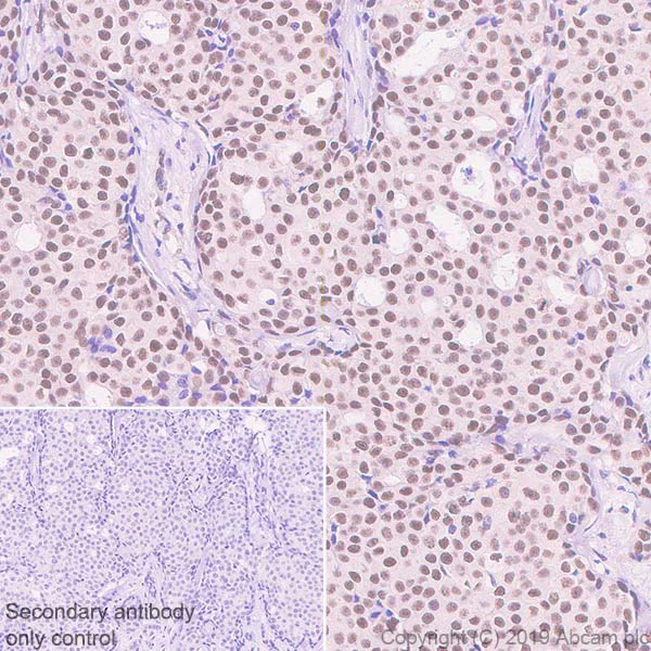 Immunohistochemistry (Formalin/PFA-fixed paraffin-embedded sections) - Anti-TRIM24 antibody [EPR22825-2] - BSA and Azide free (AB260000)