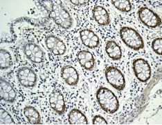 Immunohistochemistry (Formalin/PFA-fixed paraffin-embedded sections) - Anti-TRIM24 antibody [EPR6102] (AB174287)