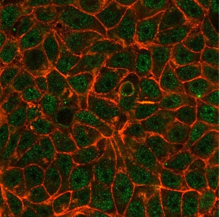 Immunocytochemistry - Anti-TRIM24 antibody [PCRP-TRIM24-1B12] (AB277106), expandable thumbnail