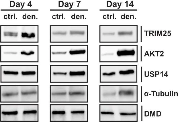Western blot - Anti-TRIM25/EFP antibody [EPR7315] (AB167154)