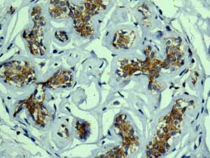 Immunohistochemistry (Formalin/PFA-fixed paraffin-embedded sections) - Anti-TRIM25/EFP antibody [EPR7315] - BSA and Azide free (ab232356), expandable thumbnail