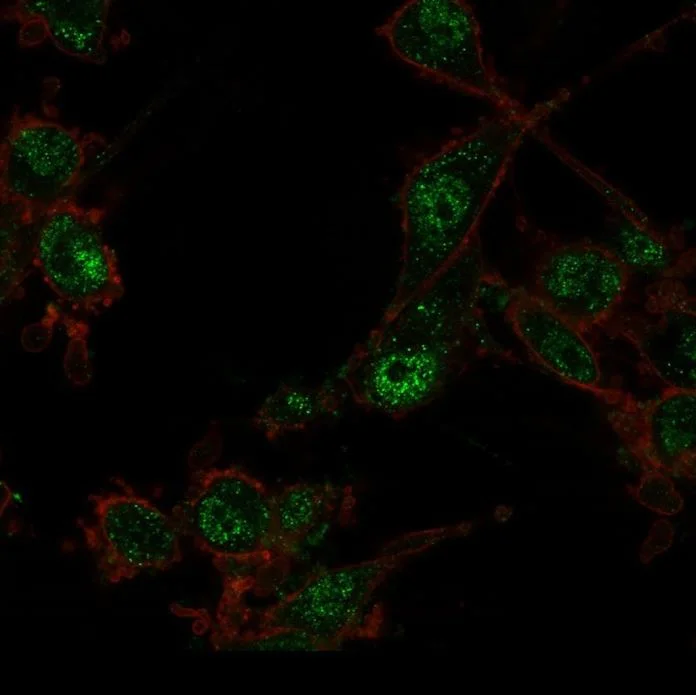 Immunocytochemistry - Anti-TRIM27 antibody [PCRP-TRIM27-1B3] (AB277103)