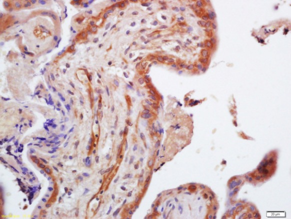 Immunohistochemistry (Formalin/PFA-fixed paraffin-embedded sections) - Anti-TRIM29 antibody (AB213158)
