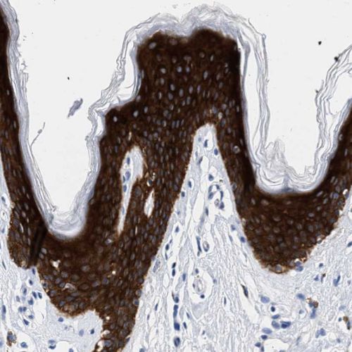 Immunohistochemistry (Formalin/PFA-fixed paraffin-embedded sections) - Anti-TRIM29 antibody (AB244380), expandable thumbnail
