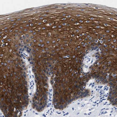 Immunohistochemistry (Formalin/PFA-fixed paraffin-embedded sections) - Anti-TRIM29 antibody (AB244380), expandable thumbnail