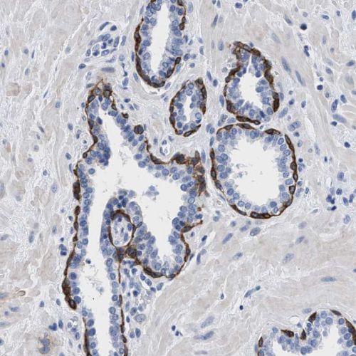 Immunohistochemistry (Formalin/PFA-fixed paraffin-embedded sections) - Anti-TRIM29 antibody (ab244380), expandable thumbnail