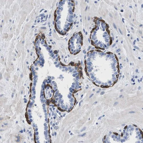 Immunohistochemistry (Formalin/PFA-fixed paraffin-embedded sections) - Anti-TRIM29 antibody (AB244380)