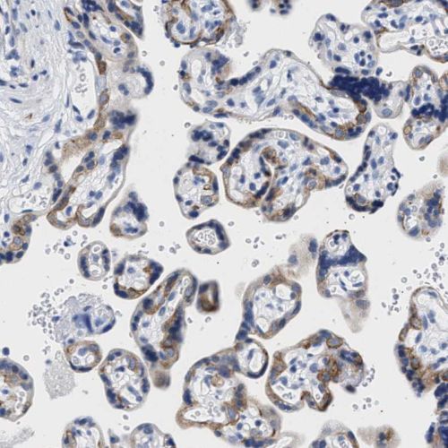 Immunohistochemistry (Formalin/PFA-fixed paraffin-embedded sections) - Anti-TRIM29 antibody (ab244380), expandable thumbnail