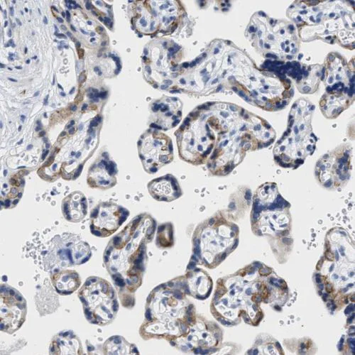 Immunohistochemistry (Formalin/PFA-fixed paraffin-embedded sections) - Anti-TRIM29 antibody (AB244380)
