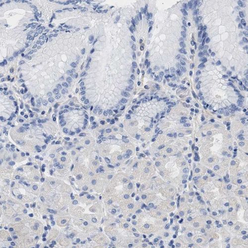 Immunohistochemistry (Formalin/PFA-fixed paraffin-embedded sections) - Anti-TRIM29 antibody (ab244380), expandable thumbnail