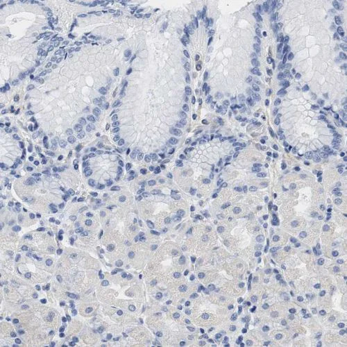 Immunohistochemistry (Formalin/PFA-fixed paraffin-embedded sections) - Anti-TRIM29 antibody (AB244380)