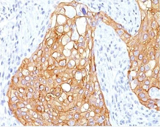 Immunohistochemistry (Formalin/PFA-fixed paraffin-embedded sections) - Anti-TRIM29 antibody [ABM43D2] (AB208287)