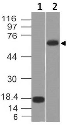 Western blot - Anti-TRIM29 antibody [ABM43D2] (AB208287), expandable thumbnail