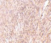 Immunohistochemistry (Formalin/PFA-fixed paraffin-embedded sections) - Anti-TRIM30/Rpt1 antibody (AB76953)