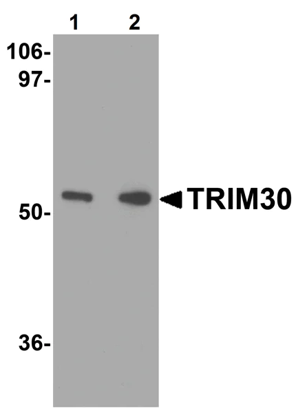Western blot - Anti-TRIM30/Rpt1 antibody (AB76953)