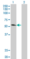 Western blot - Anti-TRIM31 antibody (AB67785), expandable thumbnail
